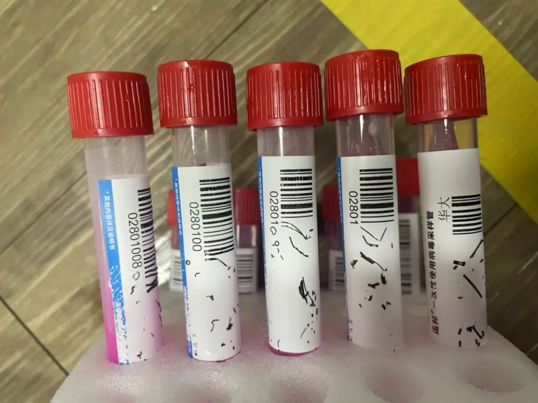 核酸采集管標簽-標簽油墨脫落起翹案例分析